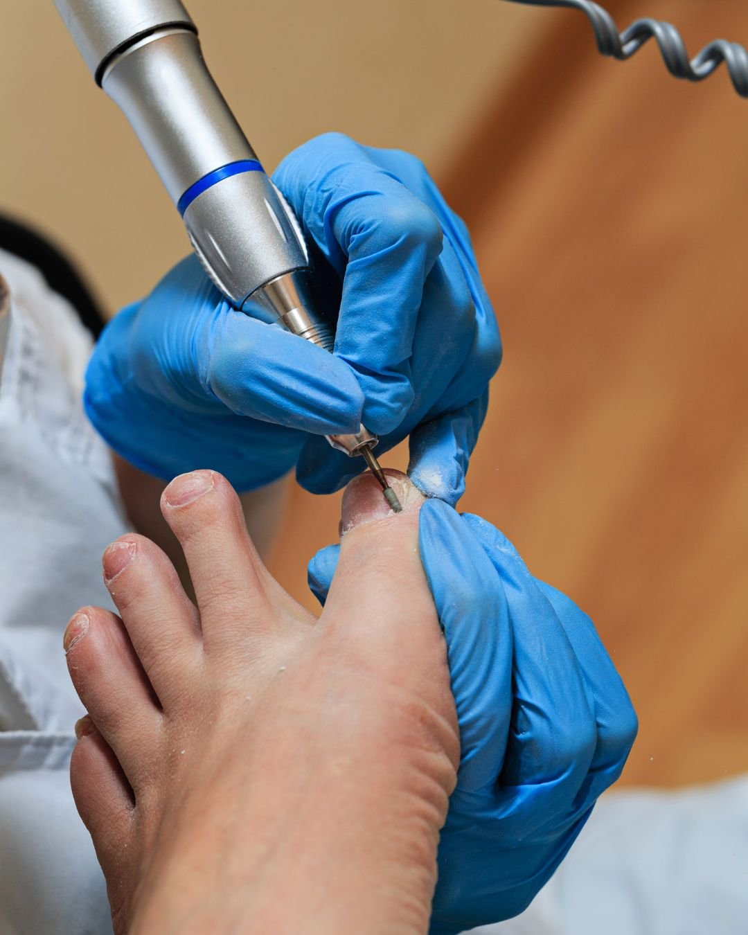 Tratamiento de podología y cuidado del pie en Clínica Fisan Madrid